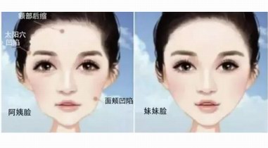  家恩德仁：整形醫(yī)生提醒您，關(guān)于脂肪填充這些事不可不知